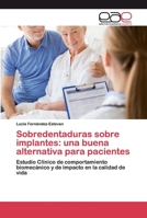 Sobredentaduras sobre implantes: una buena alternativa para pacientes 6200400741 Book Cover