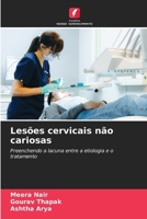 Lesões cervicais não cariosas (Portuguese Edition) 6209770363 Book Cover