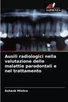 Ausili radiologici nella valutazione delle malattie parodontali e nel trattamento 6204072250 Book Cover