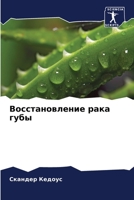 Восстановление рака губы 6206221067 Book Cover