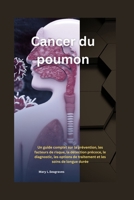 Cancer du poumon:: Un guide complet sur la prévention, les facteurs de risque, la détection précoce, le diagnostic, les options de traitement et les soins de longue durée (French Edition) B0FNFVRQ1M Book Cover