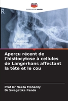 Aperçu récent de l'histiocytose à cellules de Langerhans affectant la tête et le cou (French Edition) 6208326923 Book Cover