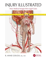 Injury Illustrated: How Medical Images Win Legal Cases 0367524171 Book Cover