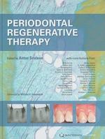 Periodontal Regenerative Therapy 1850971587 Book Cover