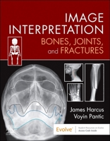 Image Interpretation: Bones, Joints, and Fractures 0323870805 Book Cover