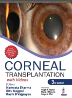 Corneal Transplantation: with Videos 9389587220 Book Cover