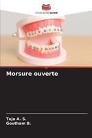 Morsure ouverte (French Edition) 6209073387 Book Cover