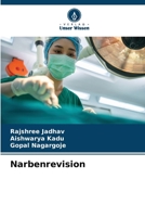 Narbenrevision (German Edition) 6206678024 Book Cover