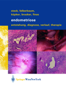 Endometriose: Entstehung, Diagnose, Verlauf Und Therapie 3211007466 Book Cover