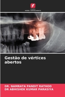 Gestão de vértices abertos 6206095231 Book Cover