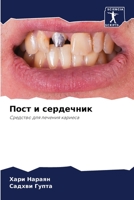 Пост и сердечник 6206423522 Book Cover