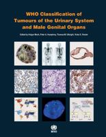 WHO Classification of Tumours of the Urinary System and Male Genital Organs 928322437X Book Cover