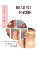 FUNGAL NAIL INFECTION: GUIDE FOR TAKING CARE OF YOUR NAIL TO PREVENT INFECTION B0CJXKCSBQ Book Cover