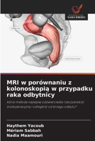 MRI w porównaniu z kolonoskopia w przypadku raka odbytnicy (Polish Edition) 6209885438 Book Cover