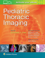 Pediatric Thoracic Imaging 1496356233 Book Cover