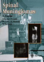 Spinal Meningiomas 8847022622 Book Cover