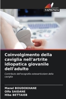 Coinvolgimento della caviglia nell'artrite idiopatica giovanile dell'adulto (Italian Edition) 6208221773 Book Cover