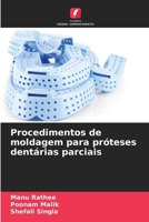 Procedimentos de moldagem para próteses dentárias parciais (Portuguese Edition) 6209801854 Book Cover