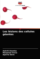 Les lésions des cellules géantes 6203369101 Book Cover