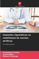 Implantes zigomáticos na reabilitação de maxilas atróficas (Portuguese Edition) 6209833373 Book Cover