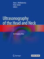 Ultrasonography of the Head and Neck: An Imaging Atlas 3030126439 Book Cover