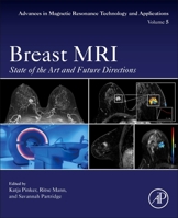 Breast MRI: State of the Art and Future Directions 012822729X Book Cover