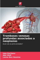 Tromboses venosas profundas associadas a neoplasias (Portuguese Edition) 6209558526 Book Cover