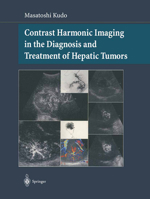 Contrast Harmonic Imaging in the Diagnosis and Treatment of Hepatic Tumors 443100002X Book Cover