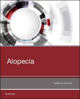 Alopecia 0323548253 Book Cover