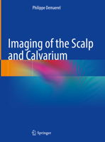 Imaging of the Scalp and Calvarium 3031496256 Book Cover