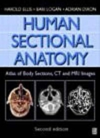 Human Sectional Anatomy: Pocket Atlas of Body Sections, CT and MRI Images 0340912227 Book Cover
