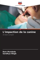 L'impaction de la canine (French Edition) 6207964357 Book Cover