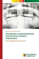 Elucidando o posicionamento dos terceiros molares impactados: Em radiografias panorâmicas 6202042311 Book Cover