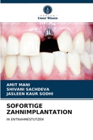 Sofortige Zahnimplantation 6203216453 Book Cover