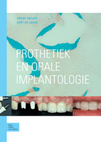 Prothetiek en orale implantologie 9031341436 Book Cover
