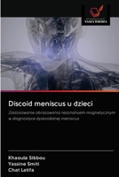 Discoid meniscus u dzieci: Zastosowanie obrazowania rezonansem magnetycznym w diagnostyce dyskoidalnej meniscus 6203127604 Book Cover