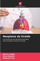 Neoplasia da tiroide (Portuguese Edition) 6207732472 Book Cover