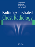 Radiology Illustrated: Chest Radiology 3642370950 Book Cover
