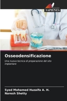 Osseodensificazione: Una nuova tecnica di preparazione del sito implantare 6206047970 Book Cover