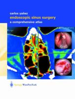 Endoscopic Sinus Surgery: A Comprehensive Atlas 3709172799 Book Cover