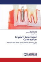 Implant Abutment Connection: Learn the past, Work in the present & Create the future 6206158535 Book Cover