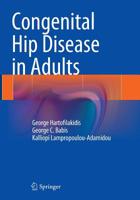 Congenital Hip Disease in Adults 8847054915 Book Cover