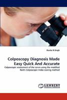 Colposcopy Diagnosis Made Easy Quick And Accurate: Colposcopic assessment of the cervix using the modified Reid's Colposcopic Index scoring method 3843362688 Book Cover