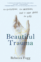 Beautiful Trauma: An Explosion, an Obsession, and a New Lease on Life 0593086775 Book Cover