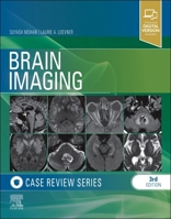 Brain Imaging: Case Review Series (Case Review) 032300430X Book Cover