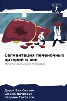 Сегментация печеночных артерий и вен: Магнитно-резонансная томография 6205876027 Book Cover