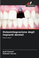 Osteointegrazione degli impianti dentali: Dalla A alla Z 6205712504 Book Cover