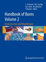Handbook of Burns Volume 2: Reconstruction and Rehabilitation 3709103142 Book Cover