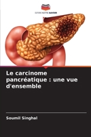 Le carcinome pancréatique : une vue d'ensemble (French Edition) 6207630467 Book Cover