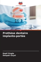 Proth�se dentaire implanto-port�e 6205330660 Book Cover